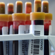 Imagen para el artículo titulado Un tipo de inmunidad al coronavirus dura al menos seis meses